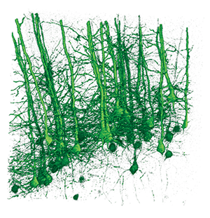 Synapses are the junctions between one neuron and another. In pruning, your brain weeds out unused or weaker synaptic contacts and keeps stronger ones, leaving you with reduced synaptic density.
Image: Courtesy of Yi Zuo, Molecular, Cell and Developmental Biology (MCDB) department, University of California Santa Cruz