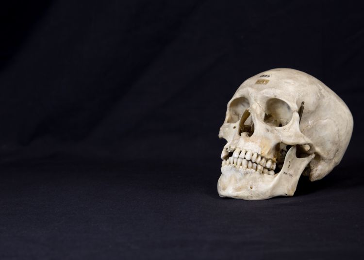 Skull of Modern Human (Homo sapiens)