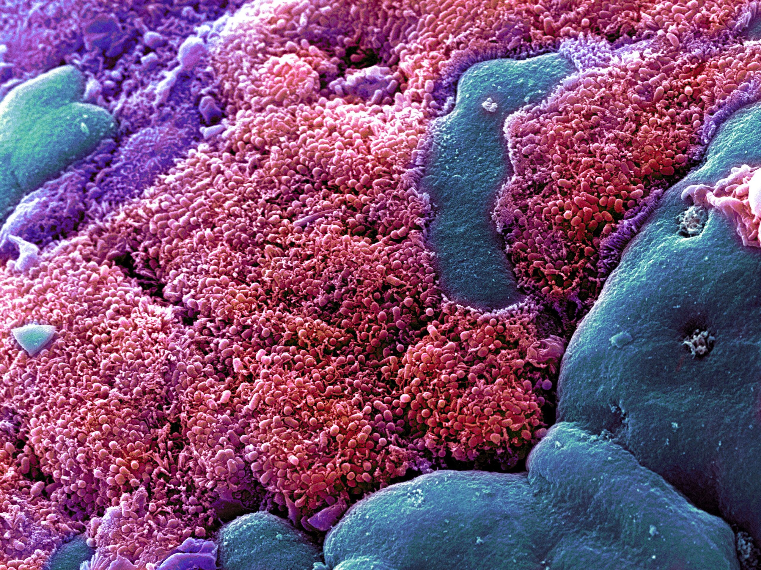 False coloured SEM image of E.coli (pink) from the small intestine. Science Photo Library