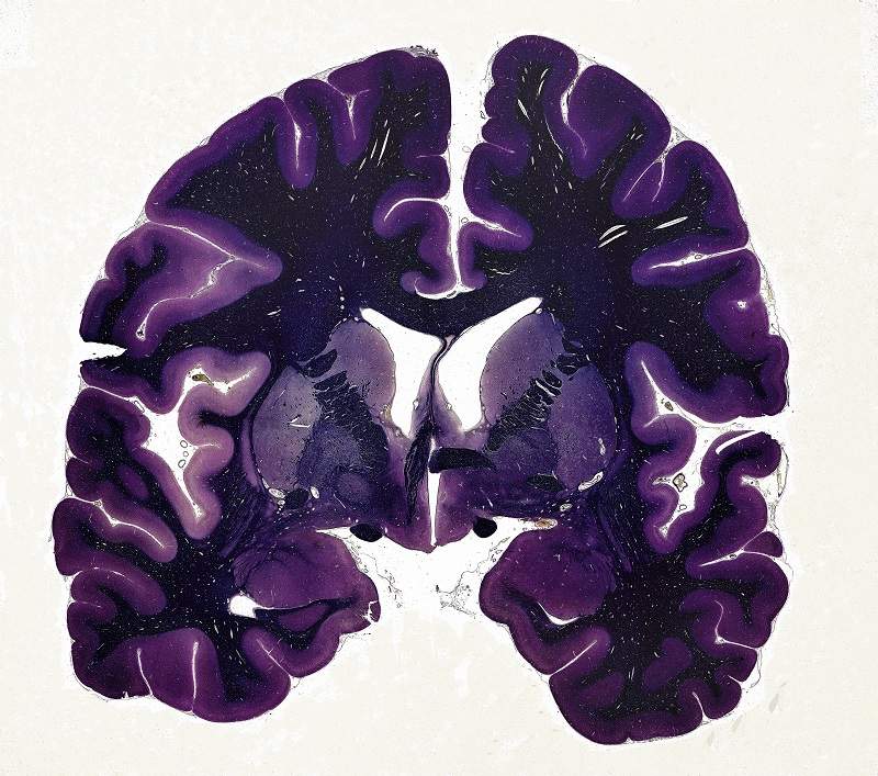 The cerebral cortex makes up about 80 percent of your brain’s mass. It contains grey matter, predominantly neuron cell bodies (light purple), and white matter axons (dark purple). It is deeply wrinkled in order to fit more neurons into a small space.
Image: Professor Michael R Peres - Wellcome Images