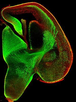 Scientists don’t fully understand how senses cross over in the brain, but in mice, they have discovered a direct connection between the ear and part of the brain that deals with smell. The image shows a mouse brain developing before birth.
Image: Abe P, Molnár Z, Tzeng YS, Lai DM, Arnold SJ, Stumm R (2015) J Neurosci. 35(38):13053-63