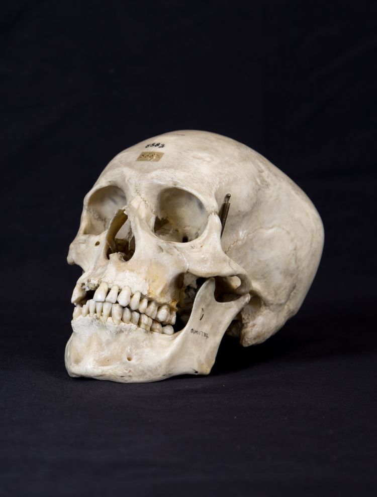 Skull of Modern Human (Homo sapiens)
